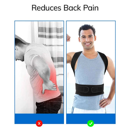 Back Brace Posture Corrector for Women & Men,Back Straightener, Scoliosis and Hunchback Correction,Adjustable Posture Trainer